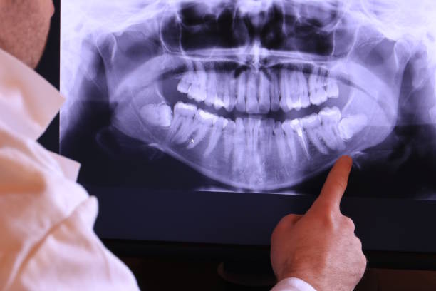 Best Emergency Root Canal Treatment in Tangent, OR